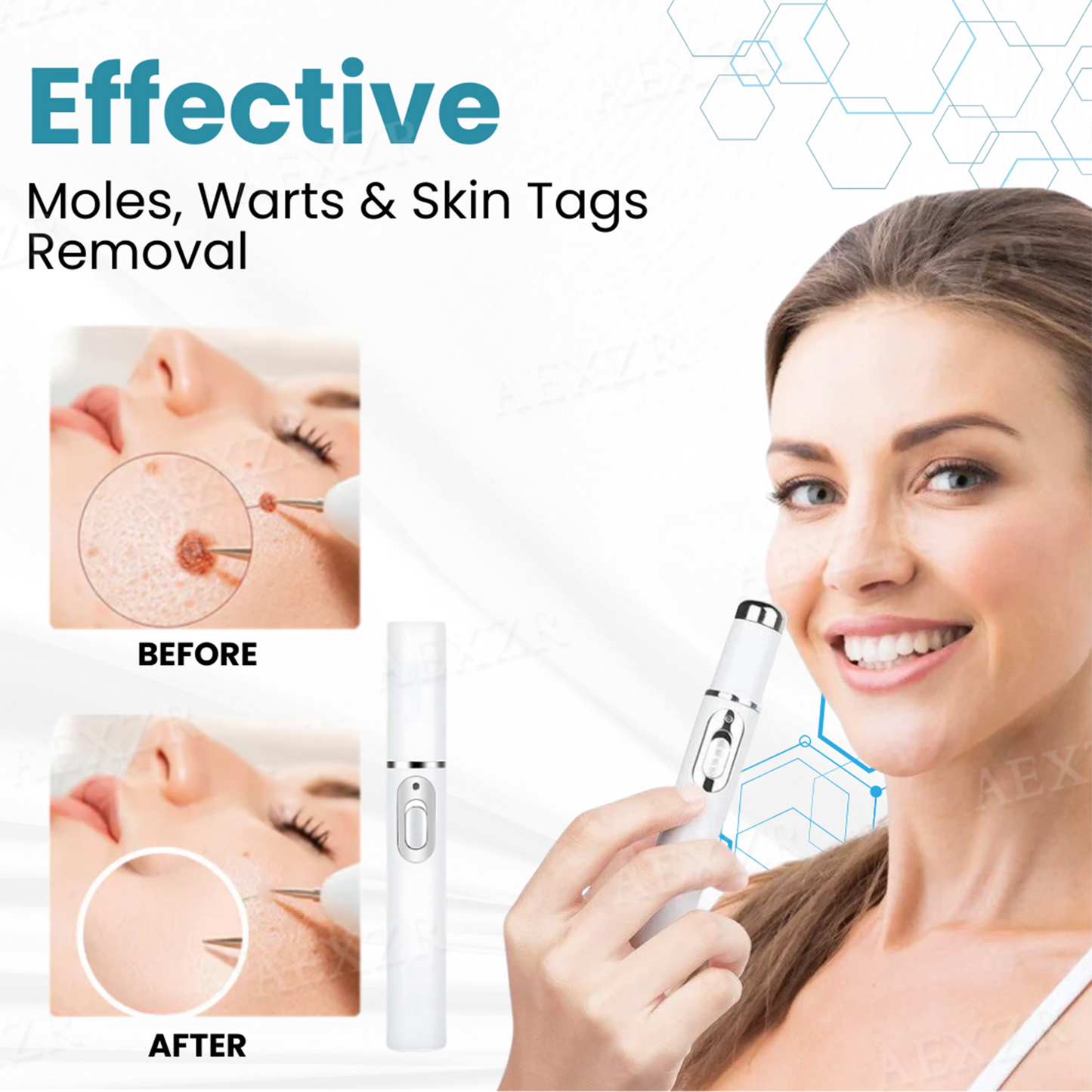 AQA™ Non-Invasive Mole and Wart Removal Laser Pen