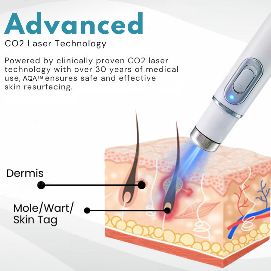 AQA™ Non-Invasive Mole and Wart Removal Laser Pen