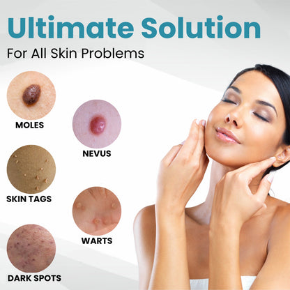 AQA™ Non-Invasive Mole and Wart Removal Laser Pen